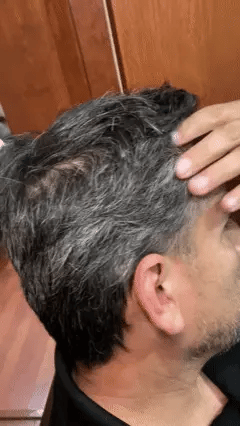 Shampoo Chao Canas +Tratmiento Gratis 2X1